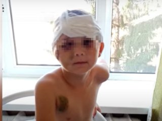 Следком Башкирии проверит факт наличия алкоголя в крови у 9-летнего сбитого мальчика