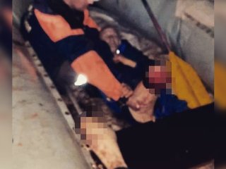 Житель Башкирии лишился ноги в аварии со скутером