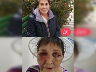 В Башкирии в психоневрологической лечебнице избили пожилую женщину