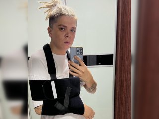 Элвин Грей сильно повредил руку во время съемок