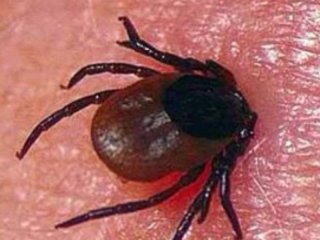 «Снимаем клещей по 10-20 штук с детей и с себя» – жительница Уфы сообщила о нашествии паразитов в их районе