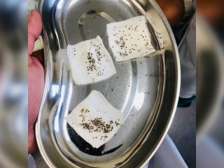 В Башкирии двоим мальчикам в реанимации удалили 465 пчелиных жал