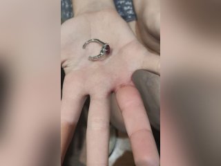 В Башкирии спасатели помогли 13-летней девочке снять кольцо с опухшего пальца