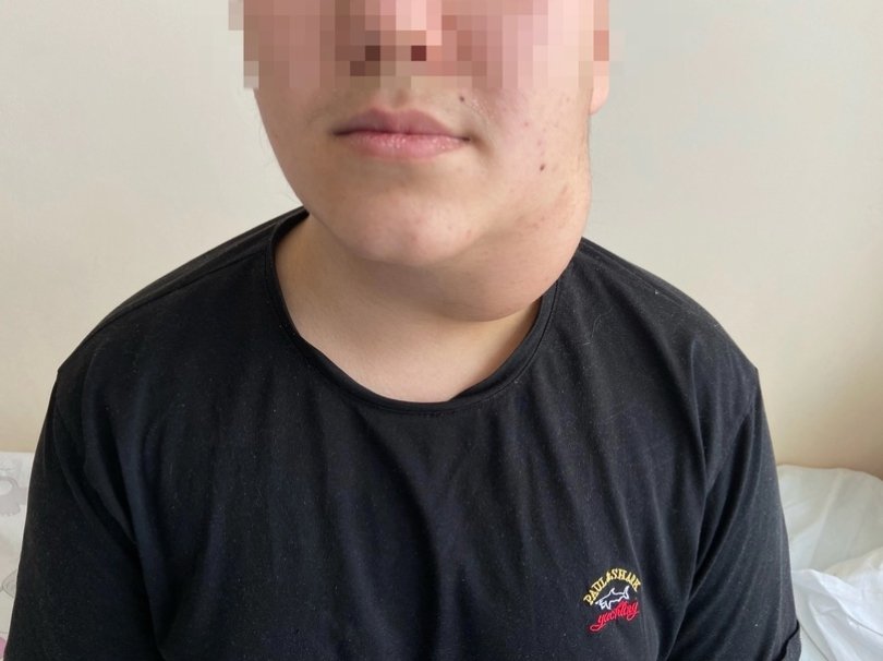 Уфимские врачи удалили огромную опухоль на шее 16-летнего подростка Уфимские врачи удалили огромную опухоль на шее 16-летнего подростка