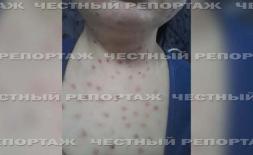 На косметолога, которая изувечила жительницу Уфы, завели уголовное дело На косметолога, которая изувечила жительницу Уфы, завели уголовное дело