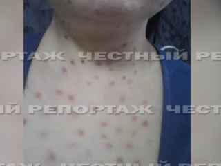 Уфимка чуть не умерла после похода к косметологу