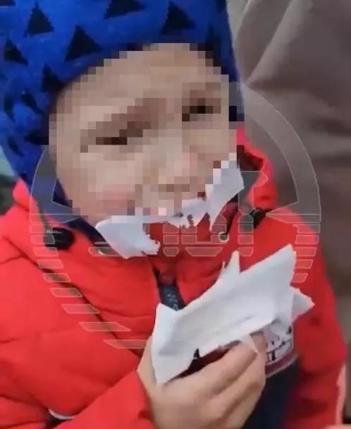 В администрации района Уфы прокомментировали случай травмирования ребенка в парке Лесоводов В администрации района Уфы прокомментировали случай травмирования ребенка в парке Лесоводов