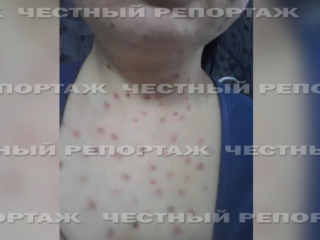 Косметолог из Уфы, изуродовавшая клиентку, продолжает вести прием