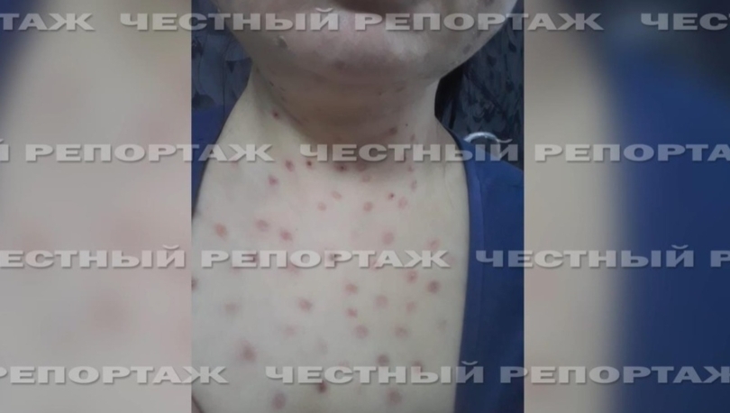 Косметолог из Уфы, изуродовавшая клиентку, продолжает вести прием Косметолог из Уфы, изуродовавшая клиентку, продолжает вести прием