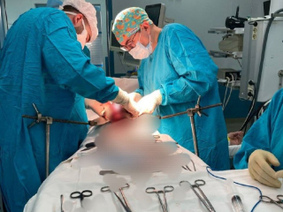 В Уфе врачи провели успешную операцию мужчине с редким случаем рака ЖКТ