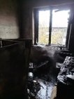 Из-за пожара в тяжелом состоянии в реанимацию попал уфимец