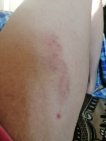 «Ребенок потерял сознание»: в Уфе во дворе на семью рухнуло дерево