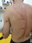 «Ребенок потерял сознание»: в Уфе во дворе на семью рухнуло дерево