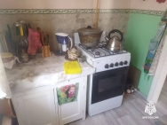В Башкирии пожилая женщина получила сильные ожоги и скончалась в больнице